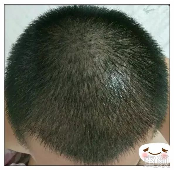 https://img.miyanlife.com/mnt/timg/180109/13150U2c-8.jpg