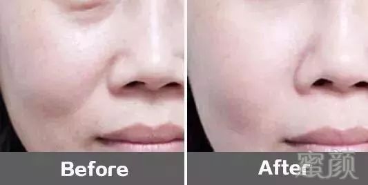 https://img.miyanlife.com/mnt/timg/180109/1322533V8-0.jpg