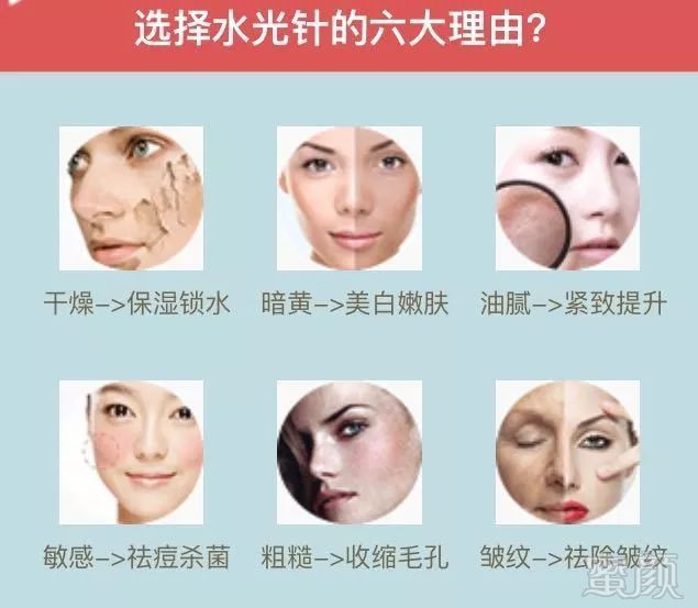 https://img.miyanlife.com/mnt/timg/180109/13225413P-3.jpg