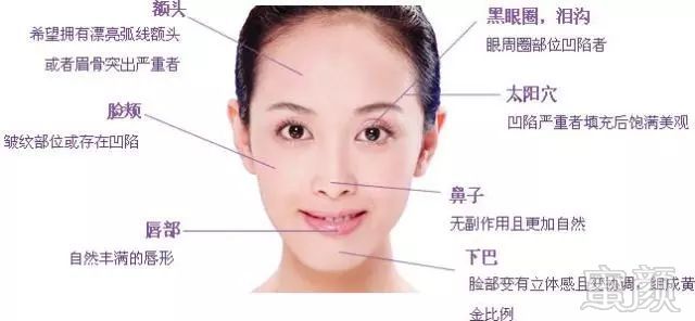 https://img.miyanlife.com/mnt/timg/180109/132U2NC-1.jpg