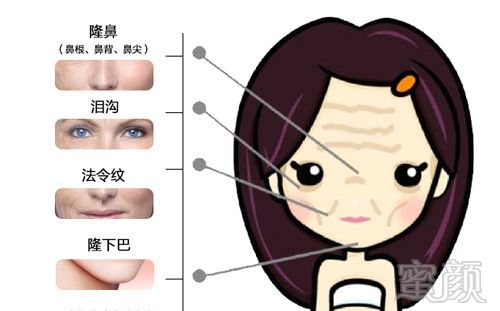 https://img.miyanlife.com/mnt/timg/180109/132U33058-5.jpg