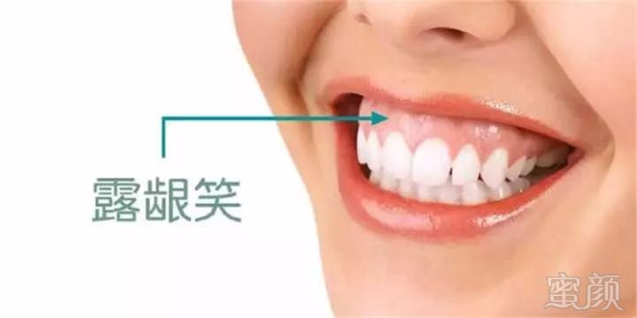 https://img.miyanlife.com/mnt/timg/180110/1204121T8-1.jpg