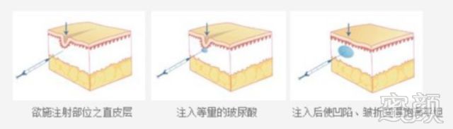 案例图片