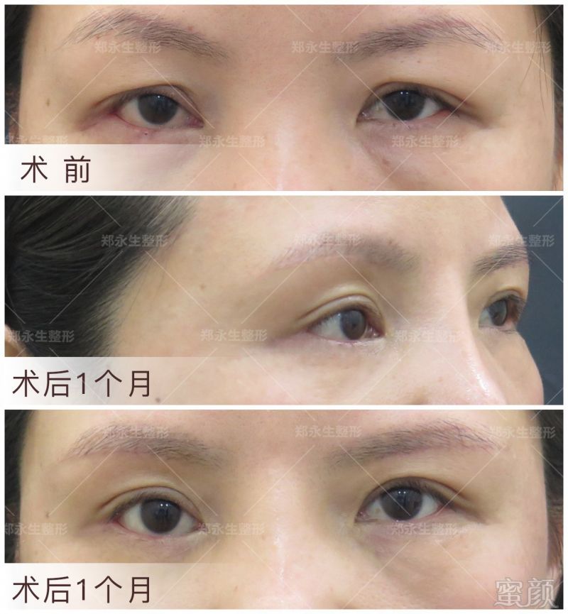 https://img.miyanlife.com/mnt/timg/180110/1250396328-0.jpg