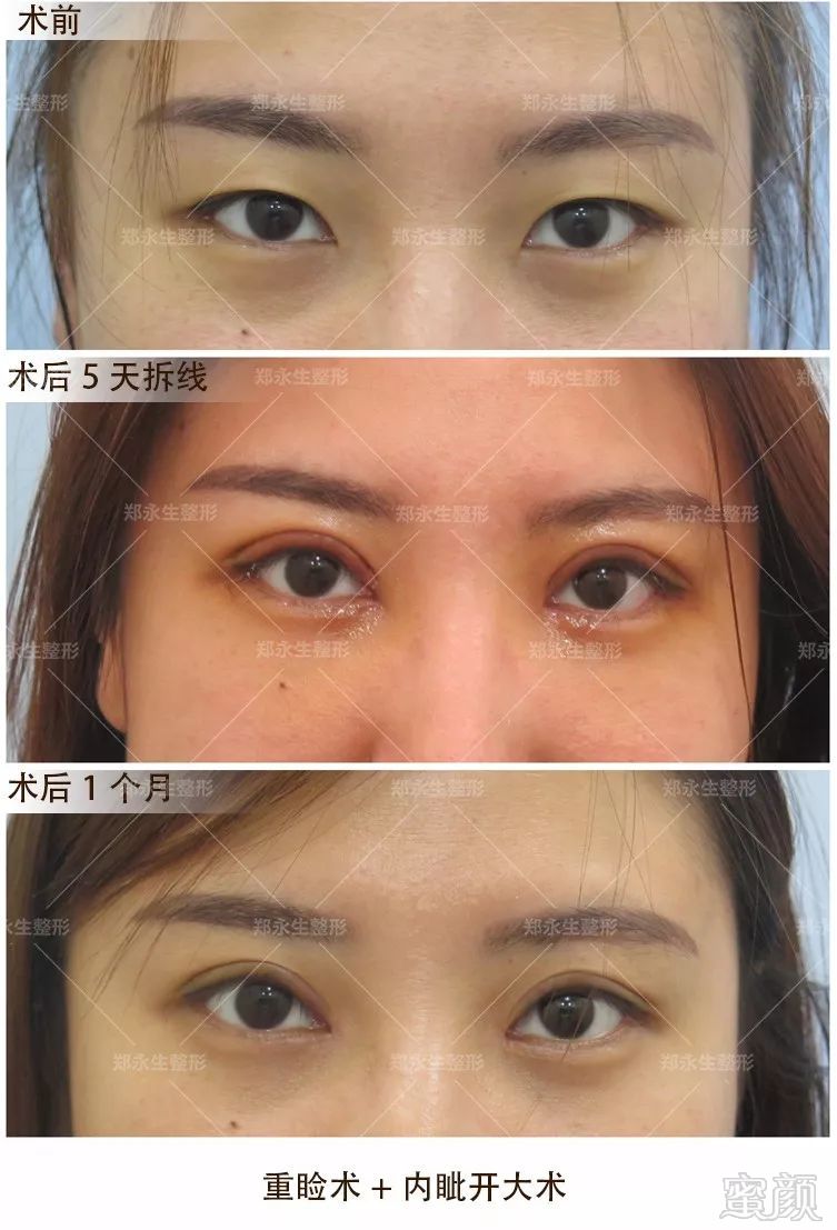 https://img.miyanlife.com/mnt/timg/180110/12504060I-3.jpg