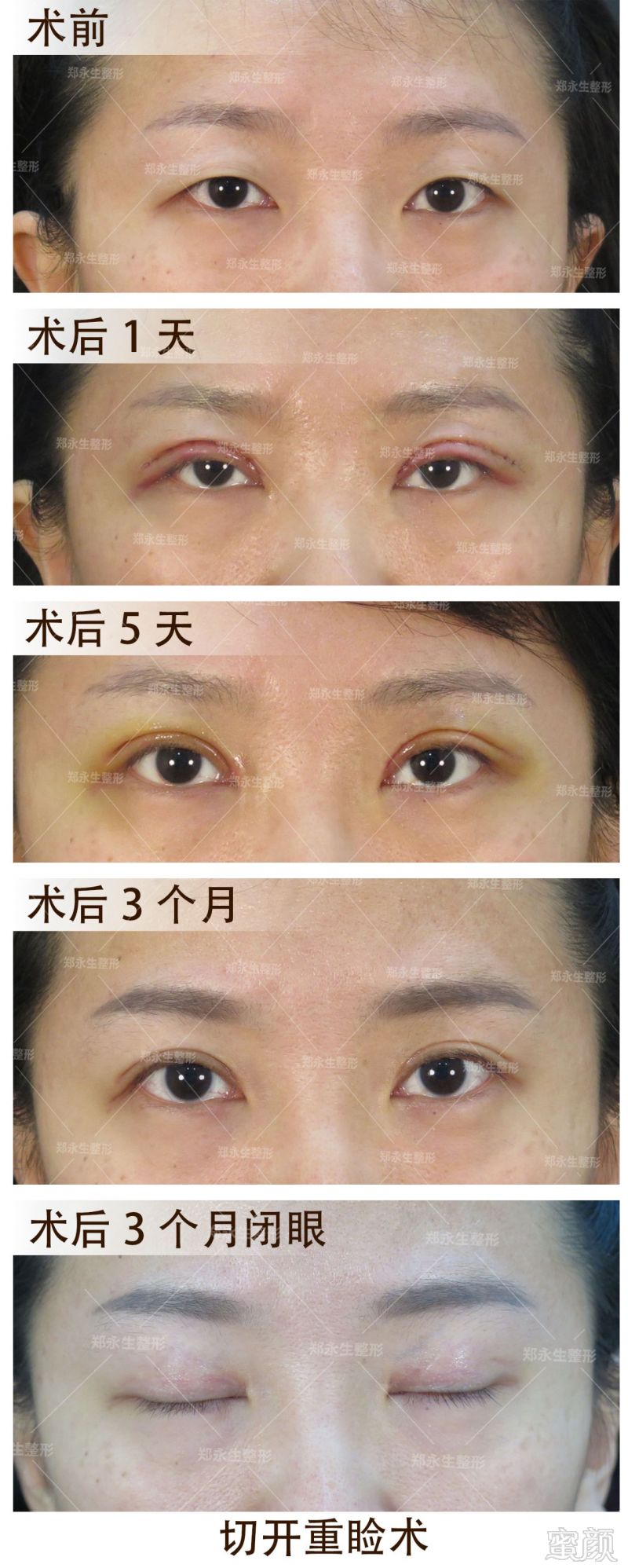 https://img.miyanlife.com/mnt/timg/180110/1250422528-7.jpg