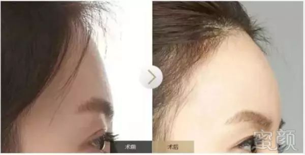 https://img.miyanlife.com/mnt/timg/180110/1253063603-7.jpg