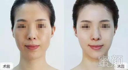 https://img.miyanlife.com/mnt/timg/180110/12534Q218-8.jpg