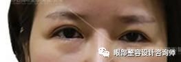 https://img.miyanlife.com/mnt/timg/180110/1304294W8-0.jpg