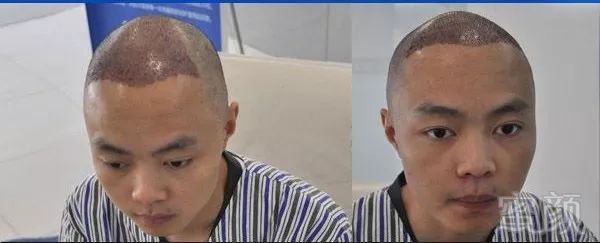 https://img.miyanlife.com/mnt/timg/180110/130F22163-4.jpg