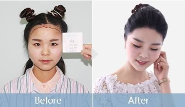 https://img.miyanlife.com/mnt/timg/180110/130F35005-10.jpg