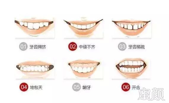 https://img.miyanlife.com/mnt/timg/180110/133Q16148-4.jpg