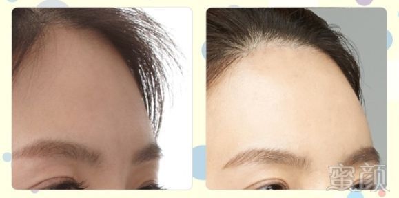https://img.miyanlife.com/mnt/timg/180110/13403143Z-10.jpg