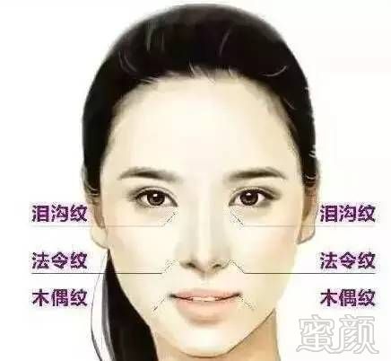 https://img.miyanlife.com/mnt/timg/180110/14014532X-0.jpg