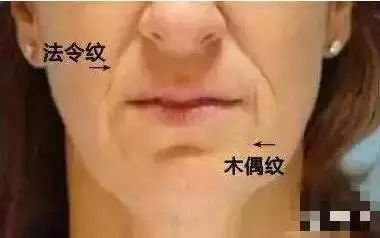 https://img.miyanlife.com/mnt/timg/180110/14014635C-2.jpg