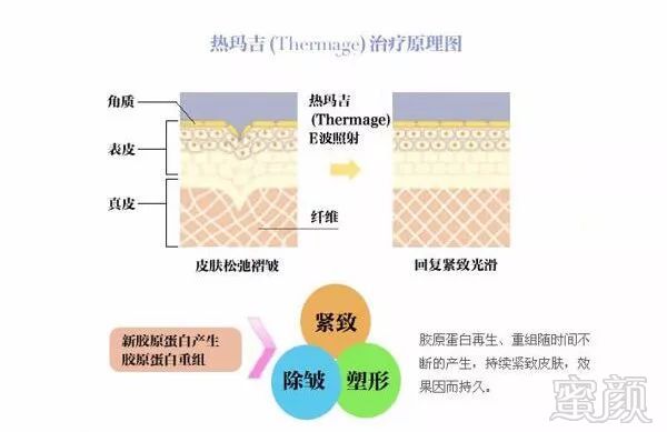 案例图片