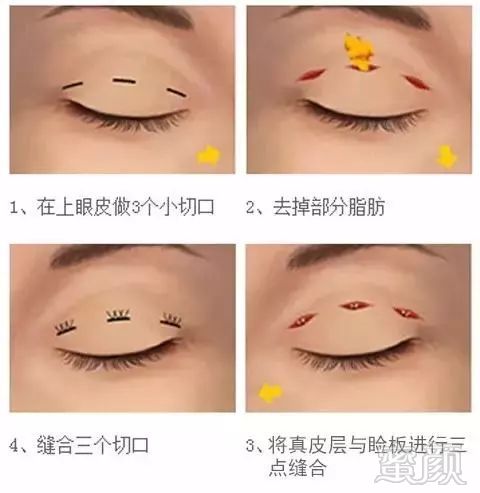 https://img.miyanlife.com/mnt/timg/180110/1411252947-2.jpg