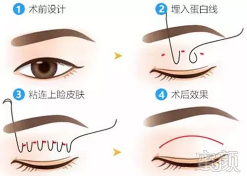 https://img.miyanlife.com/mnt/timg/180110/1411253504-1.jpg