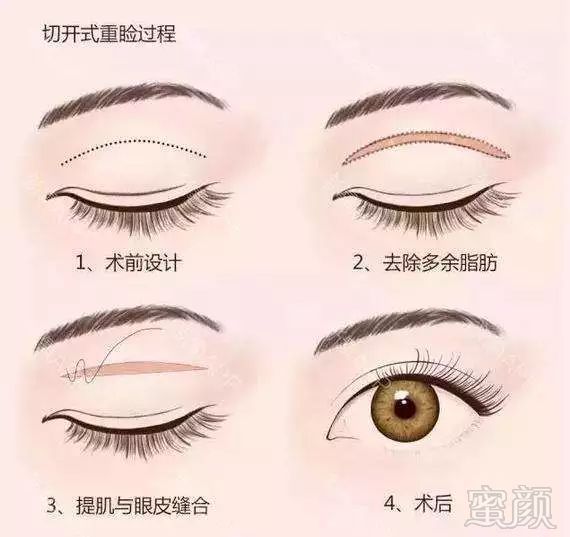 https://img.miyanlife.com/mnt/timg/180110/141125B21-3.jpg