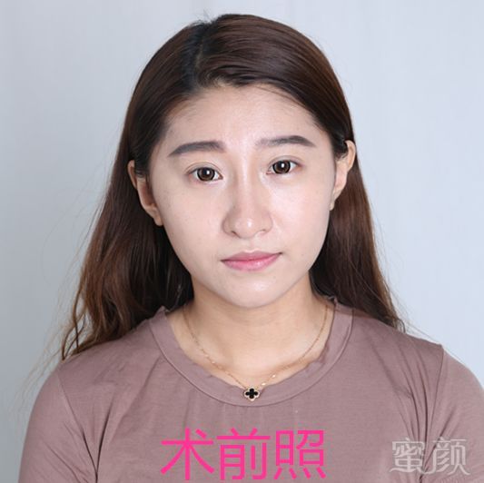 https://img.miyanlife.com/mnt/timg/180110/14145A437-0.jpg