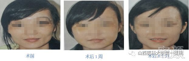 https://img.miyanlife.com/mnt/timg/180110/142I61393-5.jpg