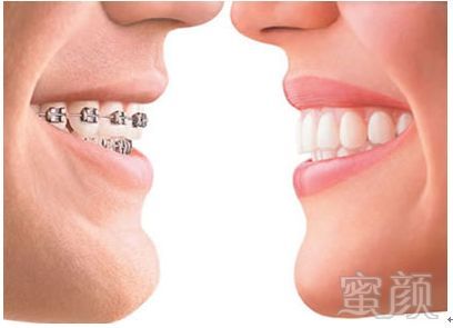 https://img.miyanlife.com/mnt/timg/180111/10542A613-3.jpg