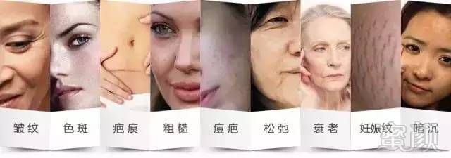 https://img.miyanlife.com/mnt/timg/180111/105K522C-1.jpg