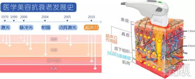 案例图片