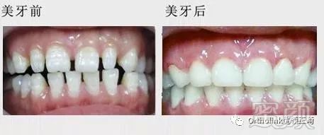 https://img.miyanlife.com/mnt/timg/180111/11252A3V-3.jpg