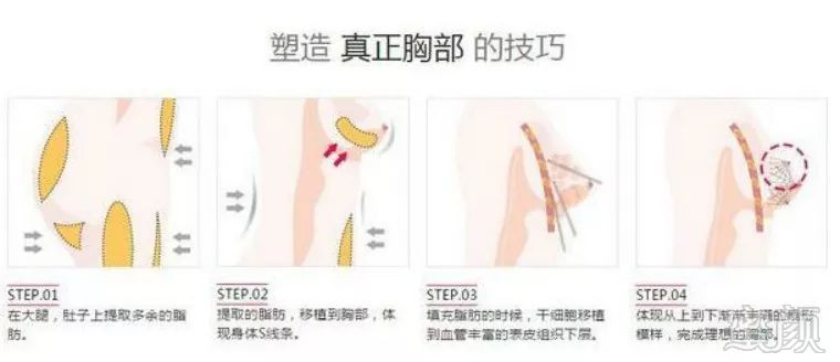 https://img.miyanlife.com/mnt/timg/180111/1134354Z5-0.jpg