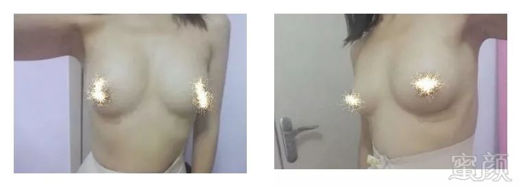 https://img.miyanlife.com/mnt/timg/180111/11343CF1-3.jpg