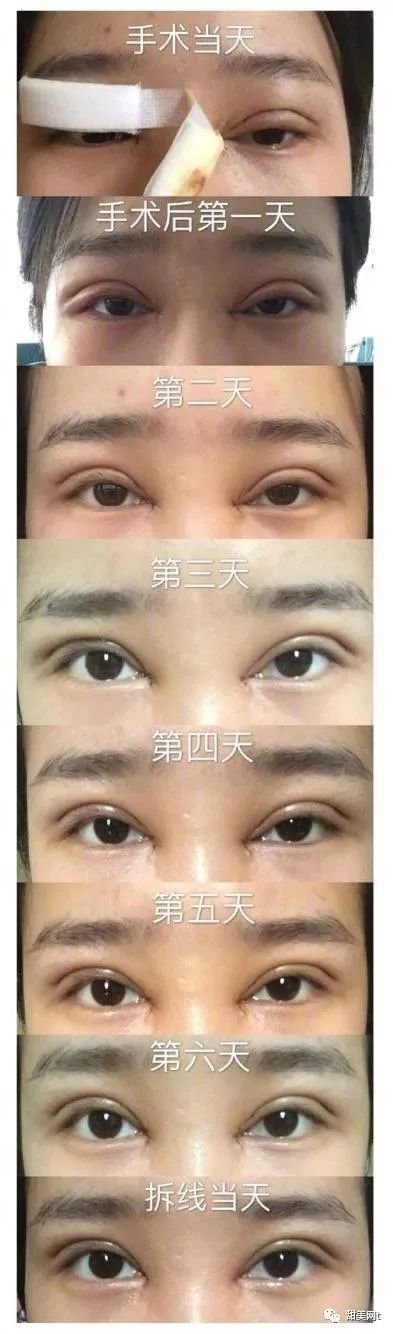 https://img.miyanlife.com/mnt/timg/180111/115A95931-0.jpg