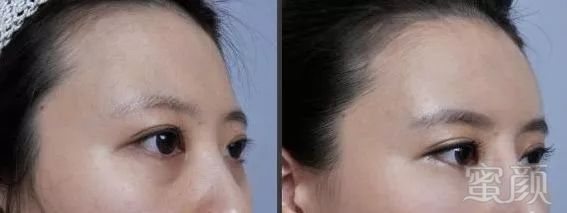 https://img.miyanlife.com/mnt/timg/180111/1226091362-4.jpg