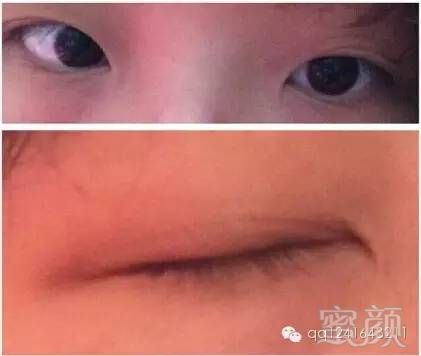 https://img.miyanlife.com/mnt/timg/180111/122S521T-0.jpg