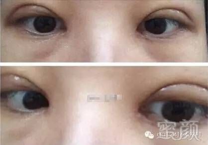 https://img.miyanlife.com/mnt/timg/180111/122S53634-3.jpg