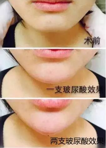 https://img.miyanlife.com/mnt/timg/180111/1240033212-3.jpg