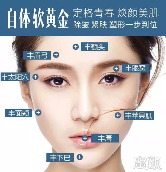 https://img.miyanlife.com/mnt/timg/180112/13494C5Z-2.jpg