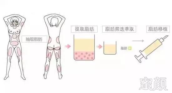 https://img.miyanlife.com/mnt/timg/180112/13494JA7-3.jpg
