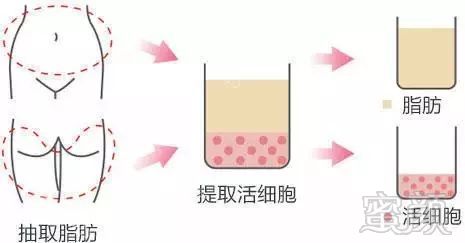 https://img.miyanlife.com/mnt/timg/180112/1354052W4-2.jpg