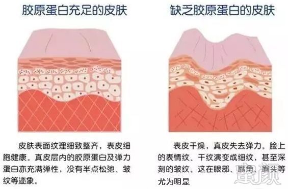 https://img.miyanlife.com/mnt/timg/180112/14002VJ9-6.jpg
