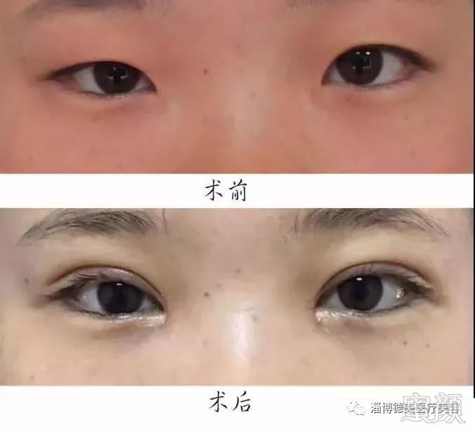 https://img.miyanlife.com/mnt/timg/180113/104H95S5-1.jpg