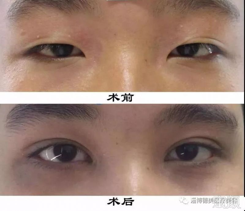 https://img.miyanlife.com/mnt/timg/180113/104I05193-5.jpg