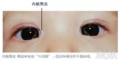 https://img.miyanlife.com/mnt/timg/180113/104I0A12-4.jpg