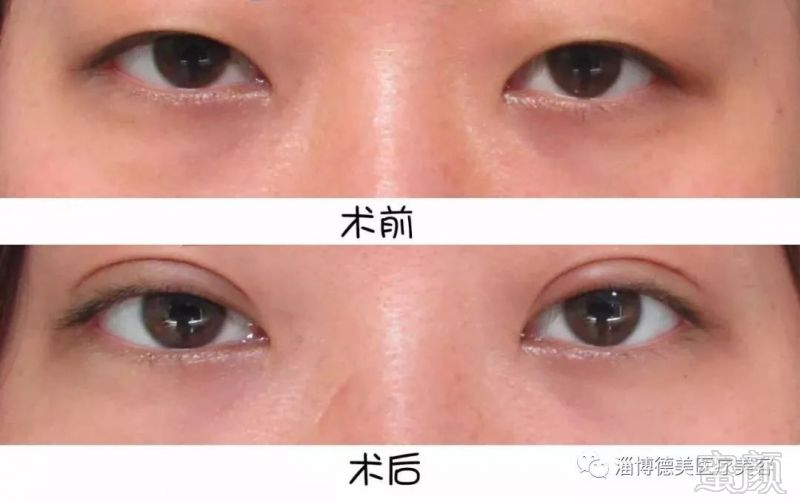 https://img.miyanlife.com/mnt/timg/180113/104I140K-7.jpg