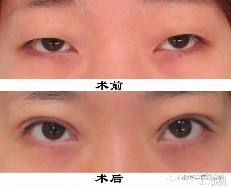 https://img.miyanlife.com/mnt/timg/180113/104I24500-10.jpg