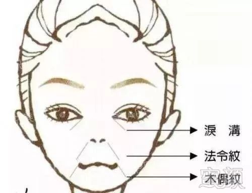 https://img.miyanlife.com/mnt/timg/180113/1153224131-2.jpg