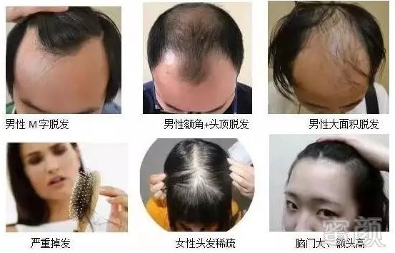 https://img.miyanlife.com/mnt/timg/180113/12163I3V-3.jpg