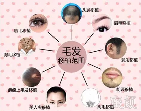 https://img.miyanlife.com/mnt/timg/180113/12163I961-2.jpg