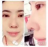 https://img.miyanlife.com/mnt/timg/180113/1251421533-3.jpg