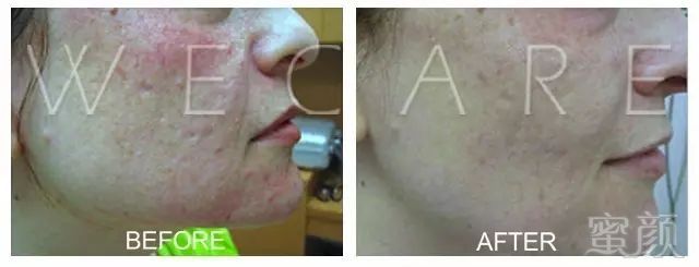 https://img.miyanlife.com/mnt/timg/180113/1255112641-10.jpg